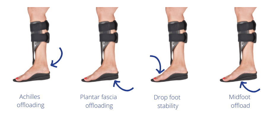 The Richie AeroSpring Brace is available in four different styles dependent on the condition and what is required. Plantar fascia offloading. Plantar fascia offloading. Drop foot stability. Mid foot offloading.